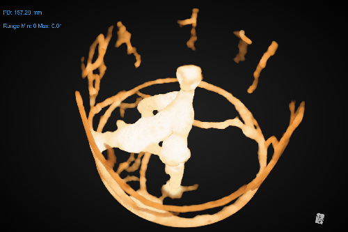 A micro-CT scan of an ant colony.